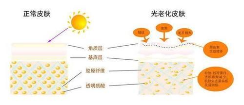  「皮肤」这5大护肤坏习惯，会让皮肤越来越差，你中招了吗？