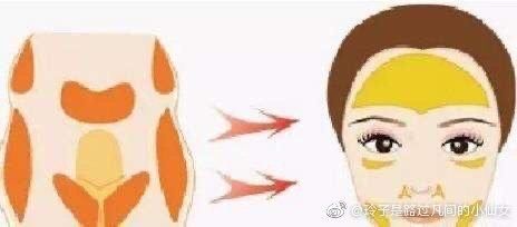  『脂肪细胞』脂肪填充多久能消肿？