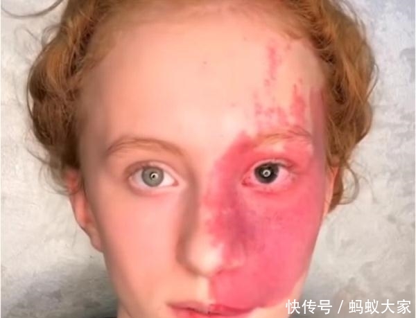  『美到』半张脸都是胎记，化妆后却美到惊艳！网友：化妆师太厉害了