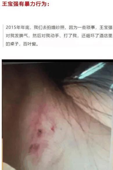 马蓉想借舆论翻盘？一个被耽误的影后，卓伟曝当年细节孰是孰非？