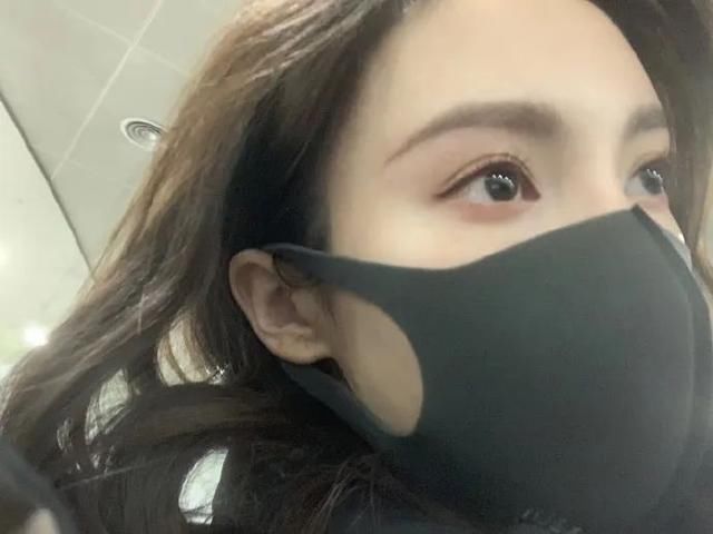  「细纹」水肿和小细纹，没想到女明星们也为了这些眼部问题操碎了心！