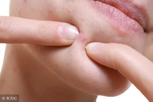 螨虫天天在脸上打洞,用这1招,脸蛋变得白白净净,开开心心等待开学