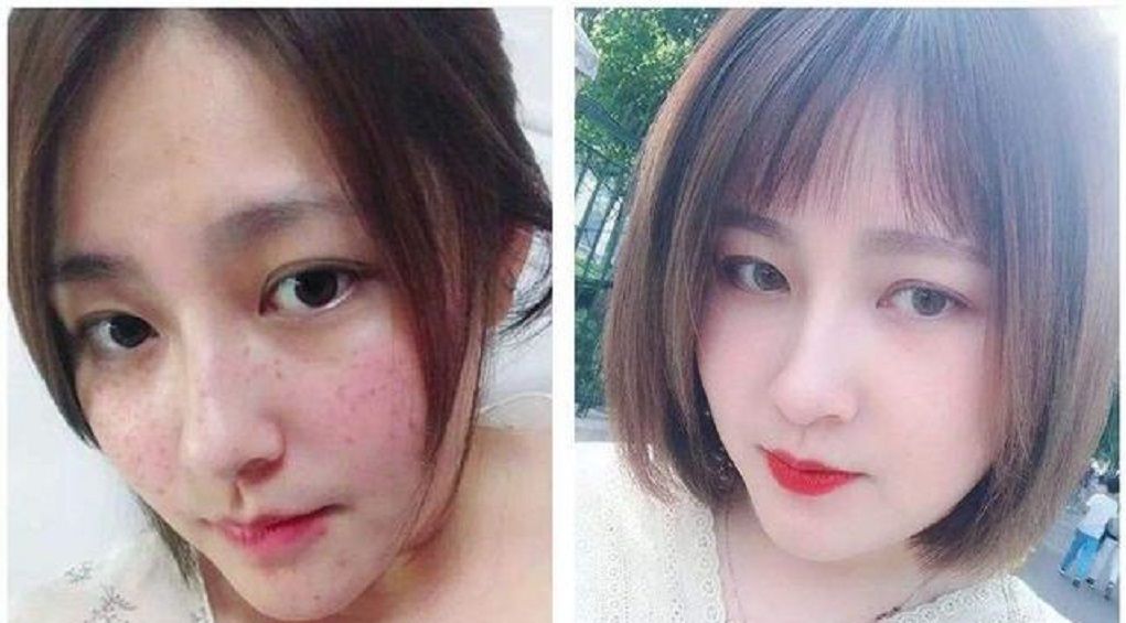  【光滑】牙膏加它敷脸,美白又淡斑,肌肤变得水嫩光滑,效果太好了