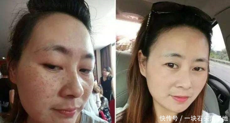 加上■阿司匹林加上常见的“它”,敷脸15天淡斑又嫩肤,皮肤白嫩有光泽