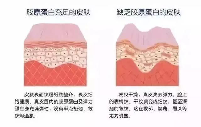晒后“烤”验！把握晒后修复黄金时段！黑了也能白回来！