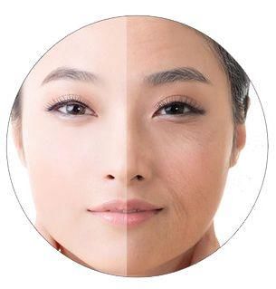 每个女人都希望青春永驻