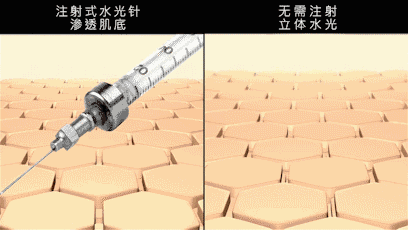  「皮下组织」热门医美项目“水光针”，真的有效果吗？
