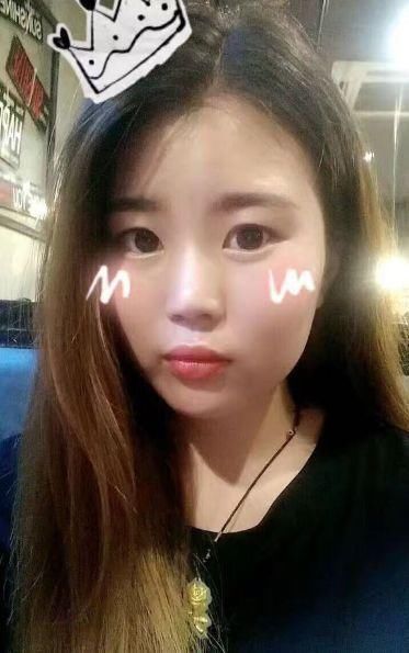 苹果最正确减肥法，天天吃，刮油排毒效果翻倍，20天掉25斤不反弹