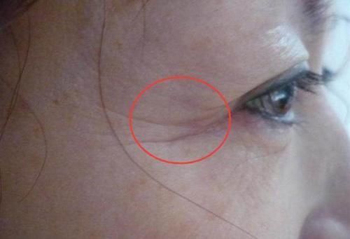 女人眼角长皱纹又丑又老,睡前抹点这些去皱宝贝,淡化细纹显年轻