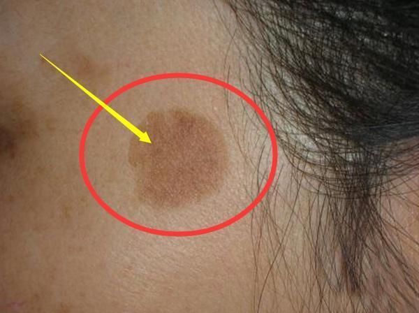 48岁小姨子泄密:药店一便宜药膏，没事抹一抹，眼袋、细纹全消