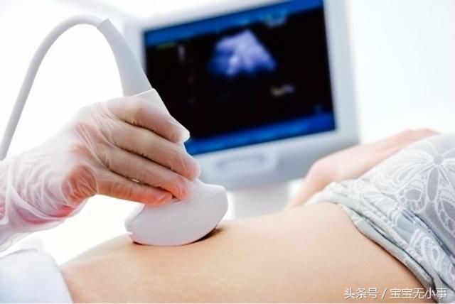 孕期的5大谣言，多数孕妇对第4个深信不疑，你信过几个？