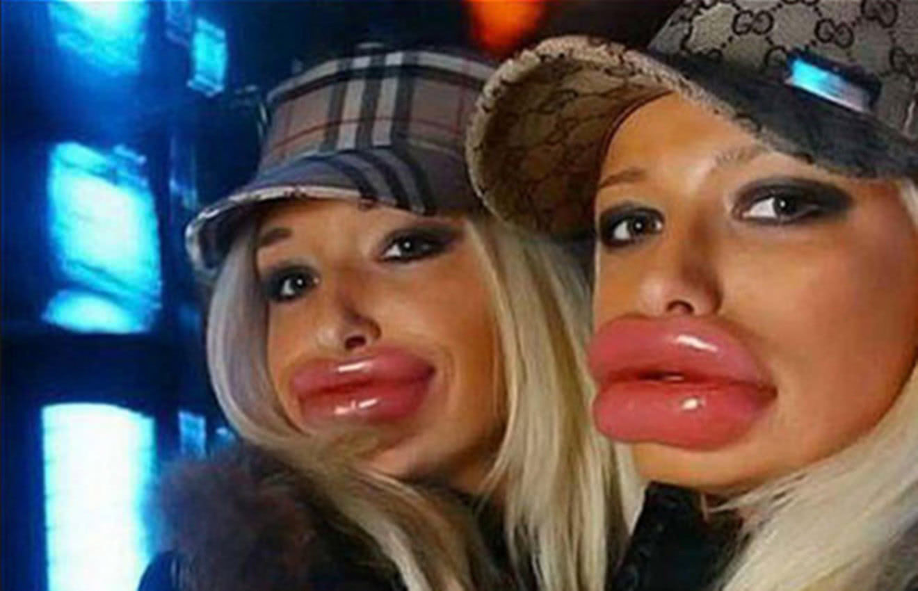 女子花费近14万整容,“只能站不能做”担心填充物会爆炸