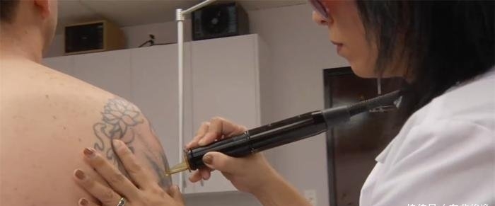 针头■纹身到底疼不疼用显微镜放大了100倍,看针头刺进皮肤有多疼