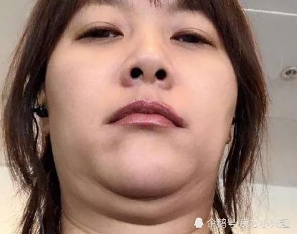  常见■女生常见的“3种脸型”，如果你是第2种，再美的五官也拯救不了！