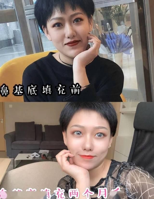  「看起来就」为什么做了整形也没有变好看