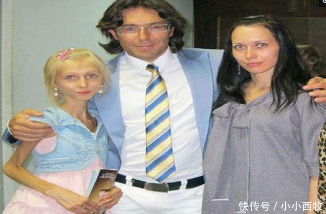 少女因害怕身体走形，每天坚持只喝水不吃食物，如今成“活骷髅”