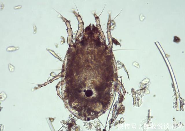 螨虫折腾你脸，4个损害的会出现，采用2招清走它！!