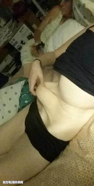 360斤胖妞甩肉220斤，肚子上的赘皮重10斤，吓跑了男友！