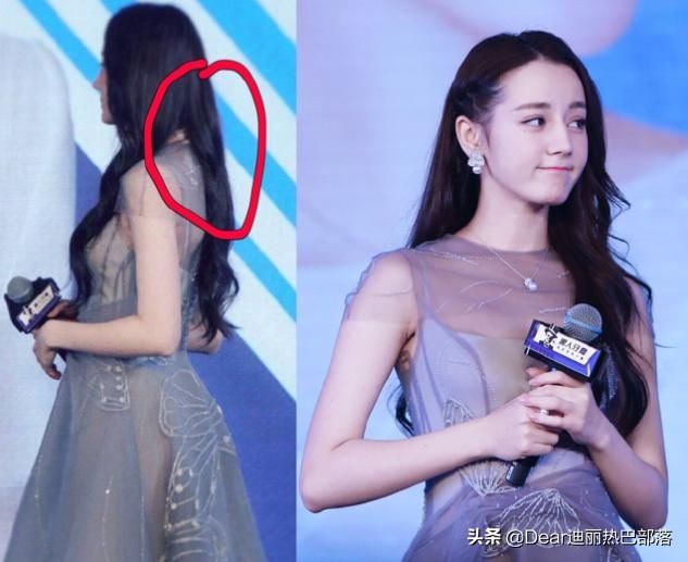  [粉丝]迪丽热巴拍戏受伤，金主爸爸为了她改地点，粉丝得到的照顾更壕