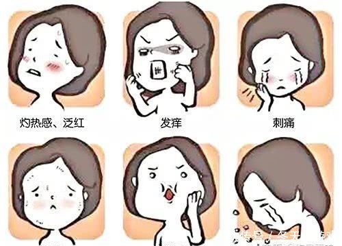 持续改善敏感肌肤:敏感肌真的能改善吗,别做梦了