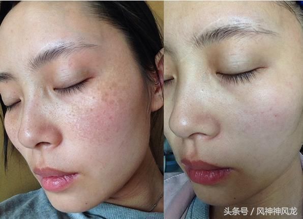 牙膏拌白醋抹脸,美白去皱,脸蛋水嫩嫩似儿童