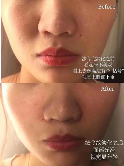  敷面膜■面膜每天一片or一周3片？敷错容易闷痘，大部分人被误导了