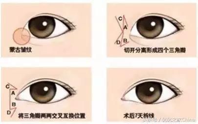 网红教科书：论斗鱼第一歌姬“冯提莫”和她的整容史