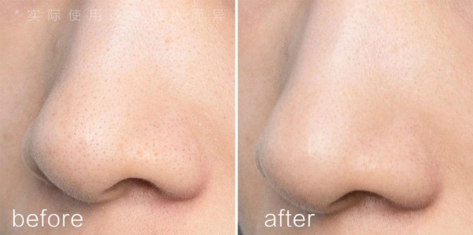 几十块就能收毛孔!这支超好用的“磨皮原液”，连我的黑头也治好