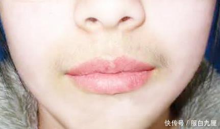 「脱毛」夏季“脱腋毛”，3处的“毛发”要脱干净，美女穿衣服都不尴尬