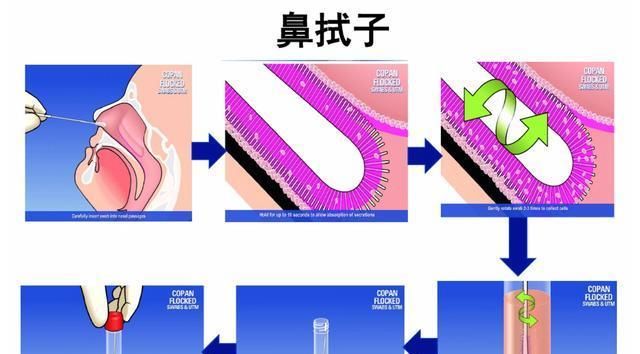 基因序列■辟谣：疫情期间同房会影响新冠病毒核酸检测的结果吗