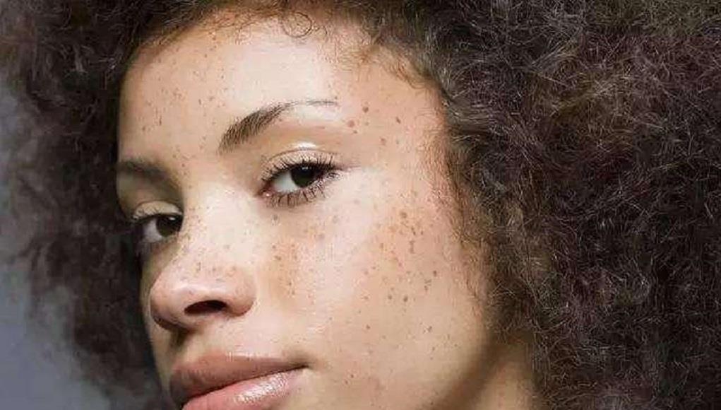  [脸部]生姜加“它”涂抹脸部，一个月淡化色斑又嫩肤，皮肤变得白皙光滑