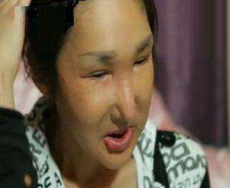 韩国女子整容走火入魔, 丈夫无奈之下只能报警!