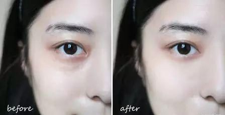 你的眼睛若亮了，生命就亮了