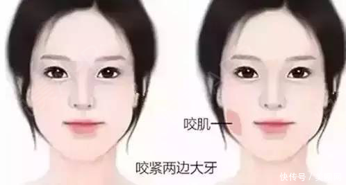 『烦恼』如何快速有效瘦脸?这样做让你摆脱大脸的烦恼