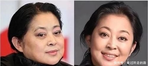 马蹄莲藕@眼袋太大,颜值被拉低!只需这样做,和眼袋说“拜拜”