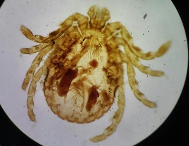 许多人不知道螨虫怕什么，3招皮肤变成“无痘肌”