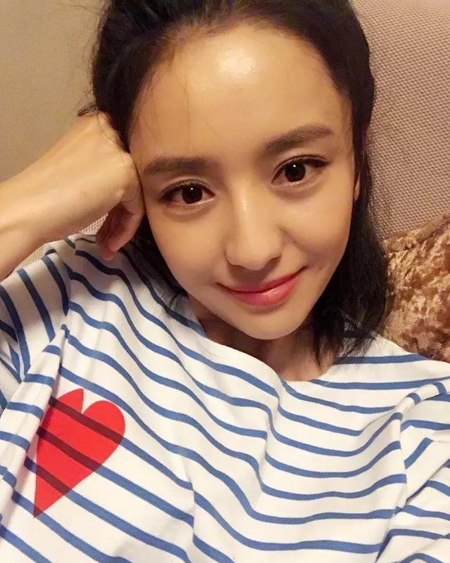  血管型黑眼圈@当妈后黑眼圈明显加重？黑眼圈不是病，挂在眼睛上真“要命”