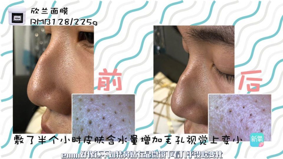 家用去黑头产品测评，这个东西对皮肤的伤害竟然这么大!