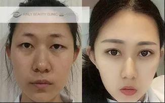 传周迅高圣远分居将要离婚?娱乐圈对女人到底有多残酷?为了戏路更