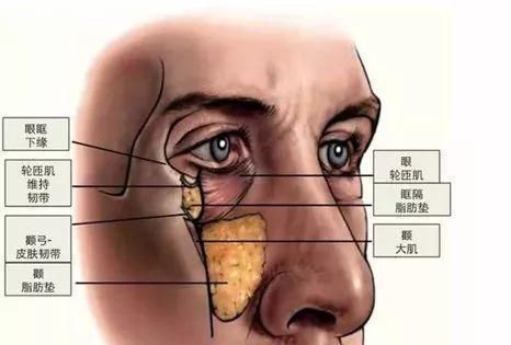  「小剂量浓注」肉毒素和玻尿酸的正确注射方法和解析（中面部篇）