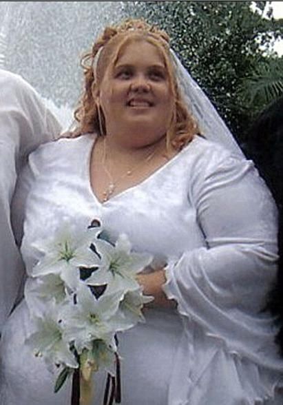 女子通过手术减肥260斤，然而后遗症却让她后悔终身！