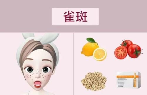  预防：脸上的斑点是如何形成的？看看这4种你有没有，最后一种可预防