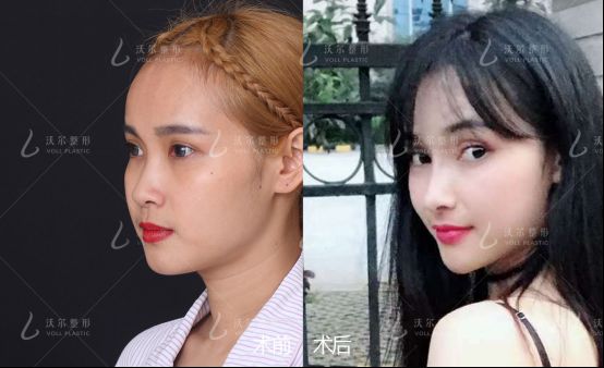 整形界女超人,14年磨砺与美同行-北京沃尔整形冯雁平