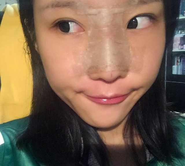  男友@小姐姐被男友带绿帽，分手后立马隆鼻，术后恢复让前任后悔莫及