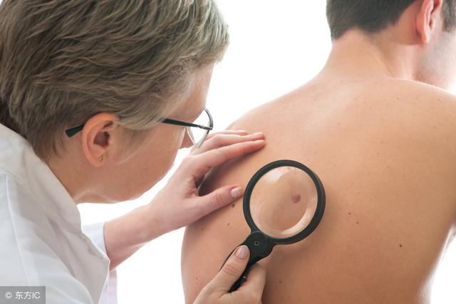 螨虫在后背疯狂爆发会有4迹象，坚持用3招一脚“踹飞”螨虫