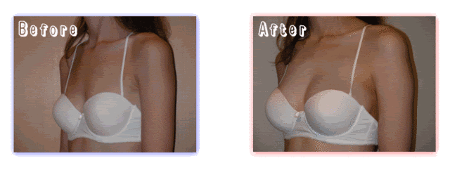 A杯已成稀有存在?日本医美级丰胸霜,帮你一次up3个杯~