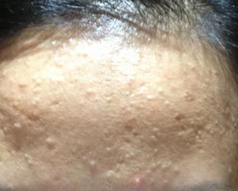 八个错误手法 毛孔突然变大