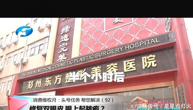 医院工作人@郑州东方整形想要修复双眼皮 谁料眼上起脓包