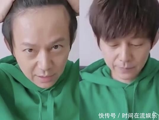  看完■看完何炅的发际线终于相信他四十多岁了