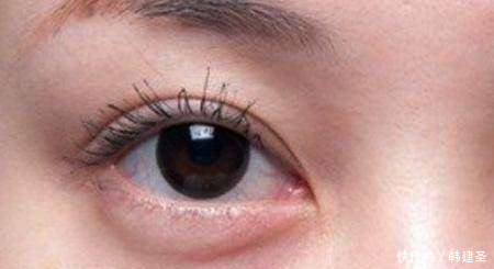 不花钱也可以祛眼袋用家里的它敷面膜，半个月眼袋皱纹全不见